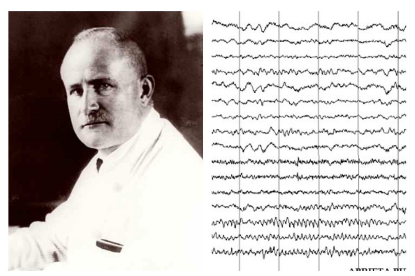 hans berger electroencefalograma neurologic international